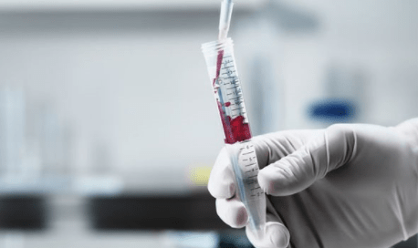 Xét nghiệm máu phát hiện ADN của khối u