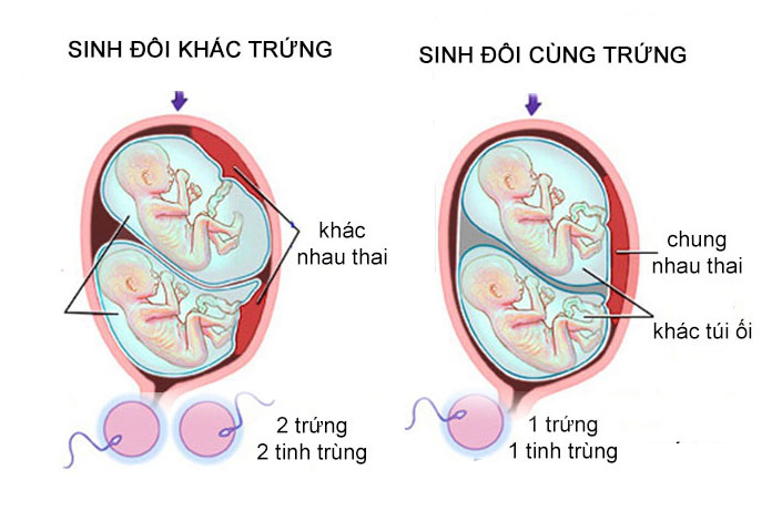 Cùng xem hình ảnh đầy ngọt ngào của hai em bé sinh đôi cùng trứng. Dù đang ở trong bụng mẹ nhưng hai bé đã mang lại niềm vui và hạnh phúc cho cả gia đình. Sẽ rất thú vị và bất ngờ khi được chiêm ngưỡng bức hình đầy tình cảm này.